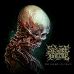 Severe Torture - Torn from...